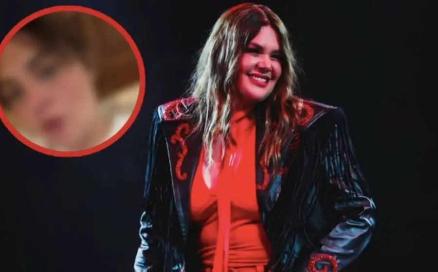 La cantante Yuridia muestra la quemadura que sufrió en su rostro como resultado de una reacción al aciclovir para tratar herpes.