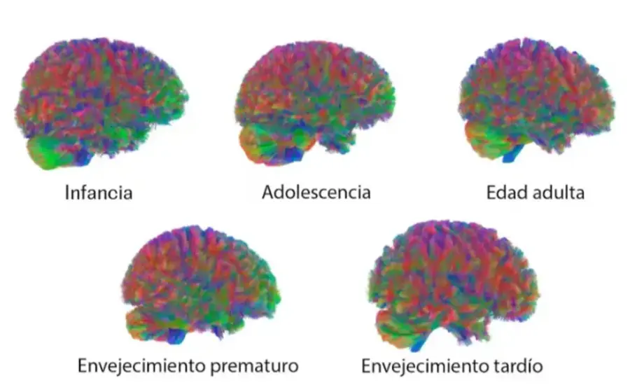 Ilustración del cerebro humano que muestra sus etapas de reinvención, destacando que la fase adolescente dura hasta los 32 años según la ciencia.